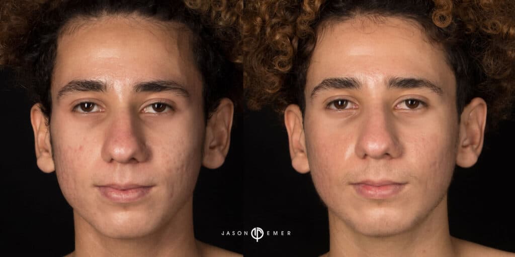 Patient before and after