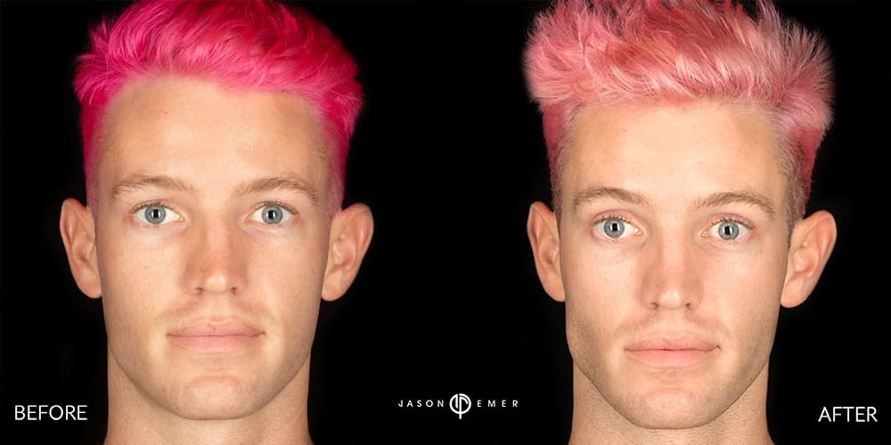 Patient before and after