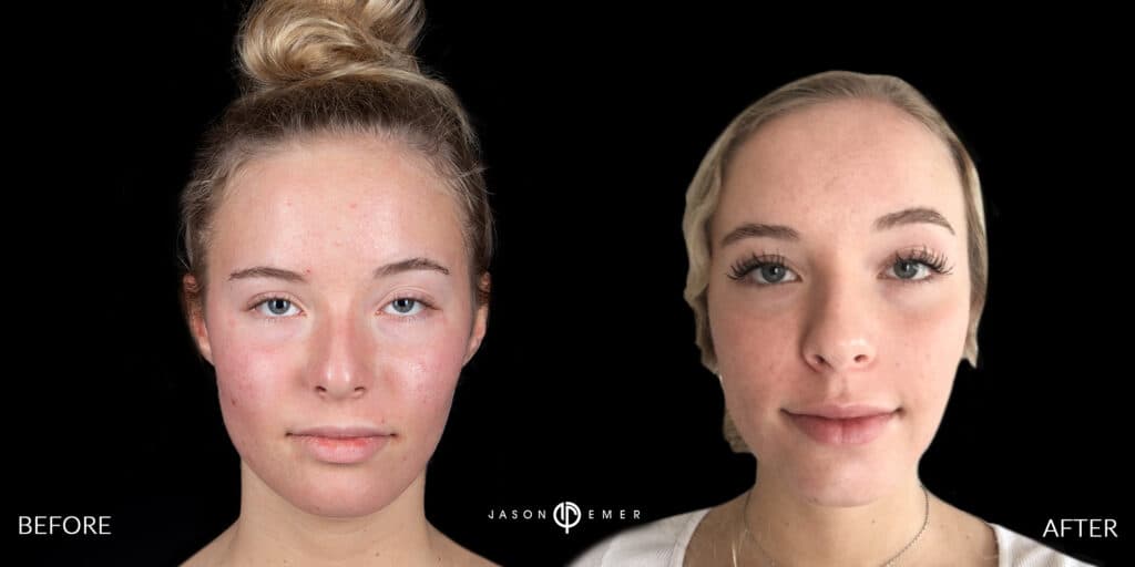 Patient before and after