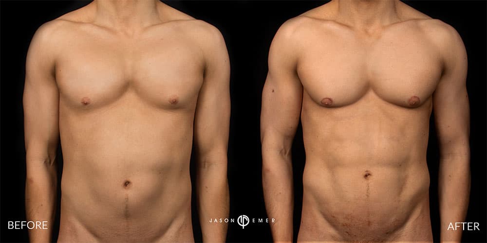 Patient before and after