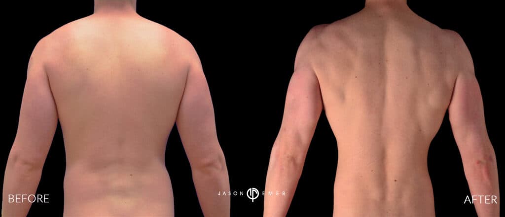 Back Male Gallery