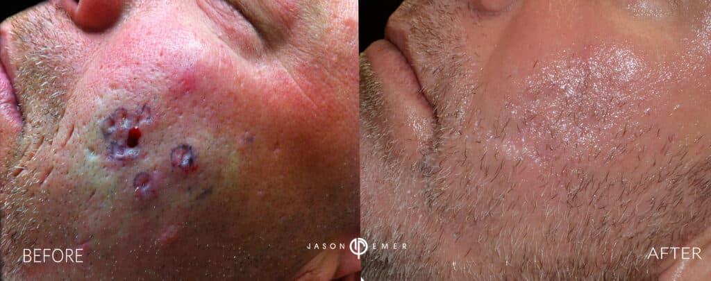 Patient before and after
