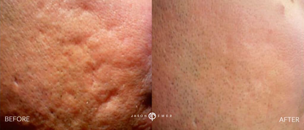 Patient before and after
