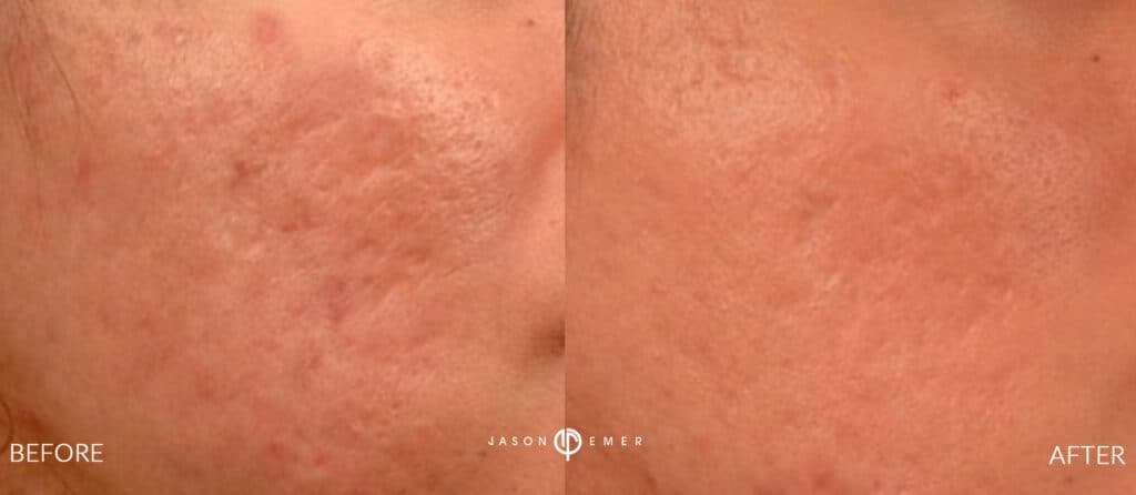Patient before and after