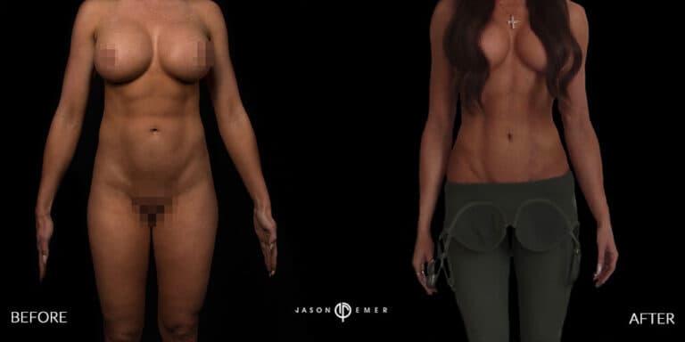 FULL BODY FEMALE GALLERY 01