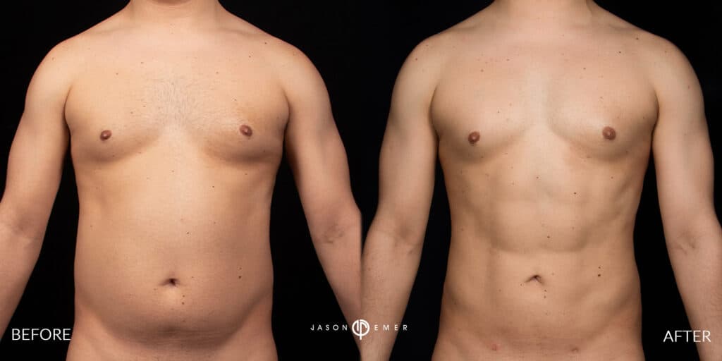 Patient before and after