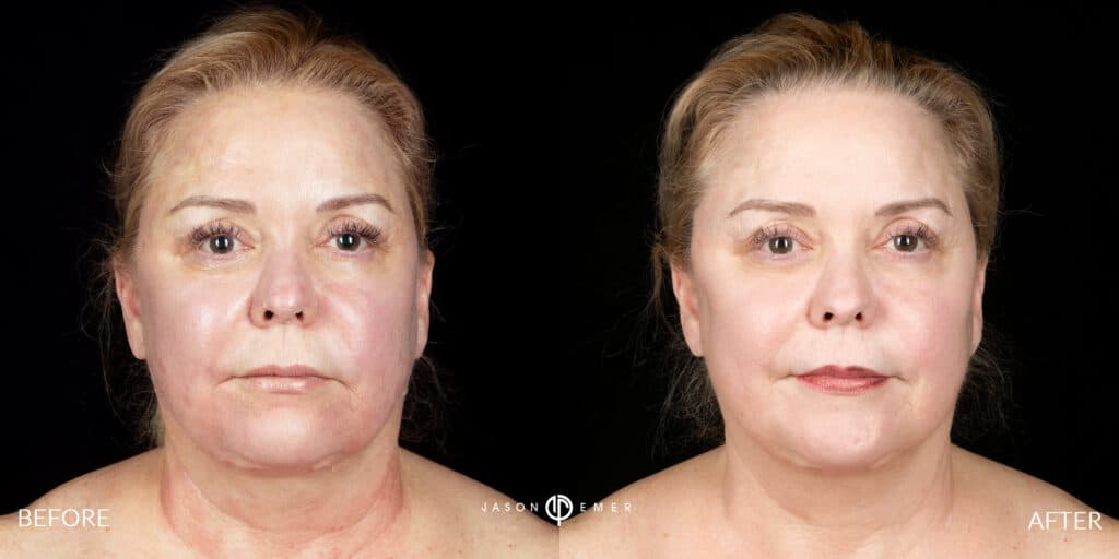 Patient before and after