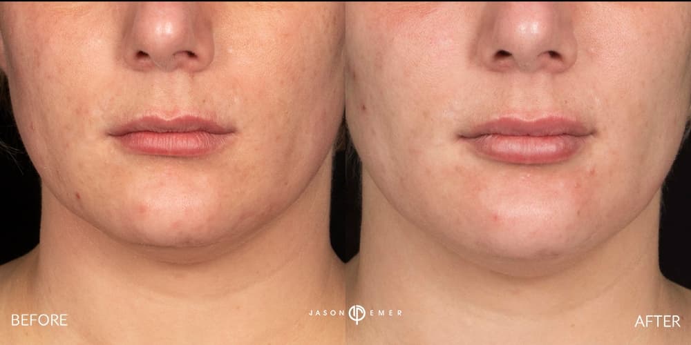 Patient before and after