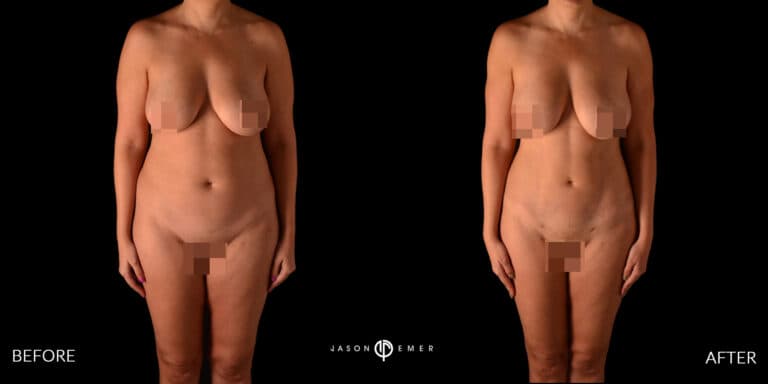 FULL BODY FEMALE GALLERY 04