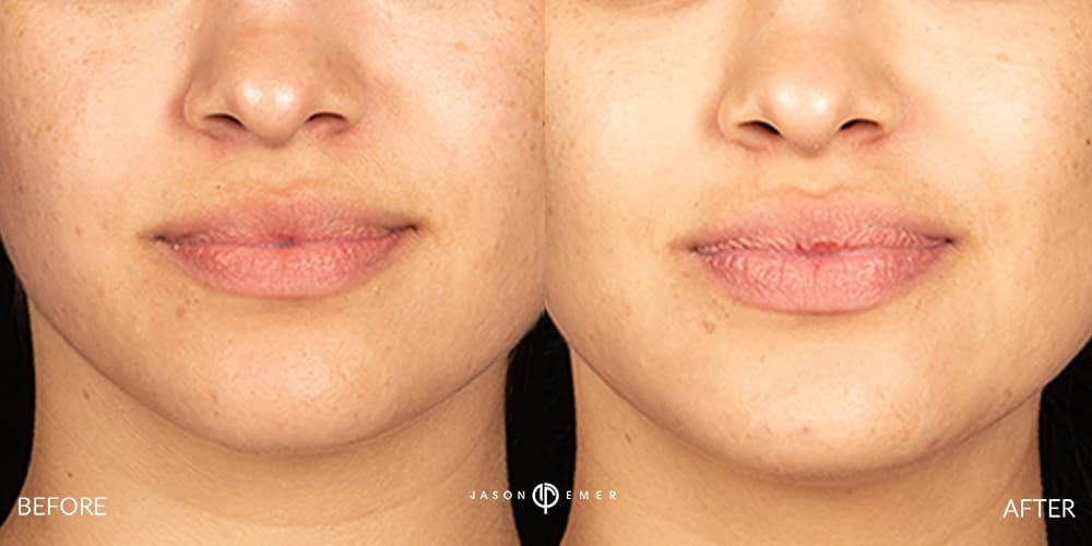 Patient before and after