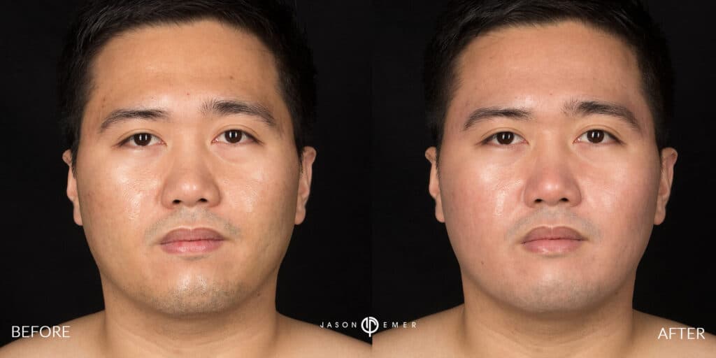 Patient before and after