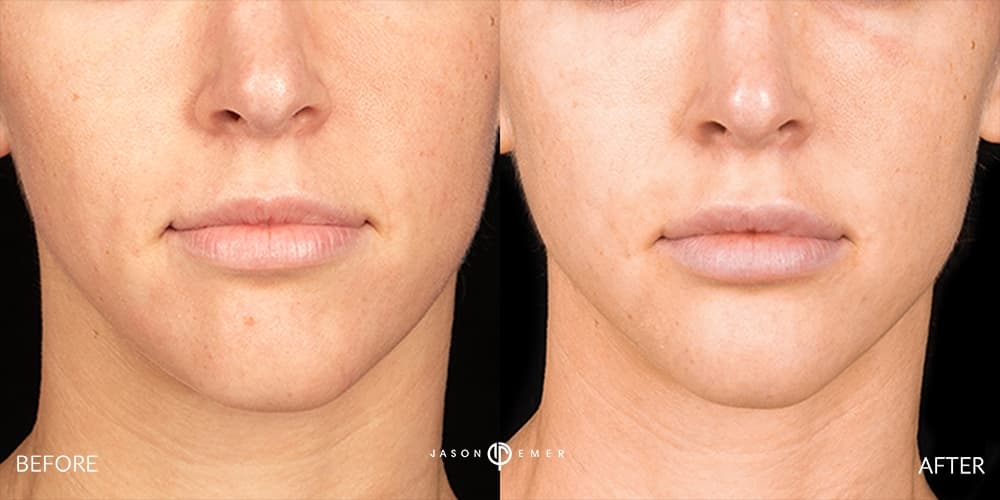 Patient before and after