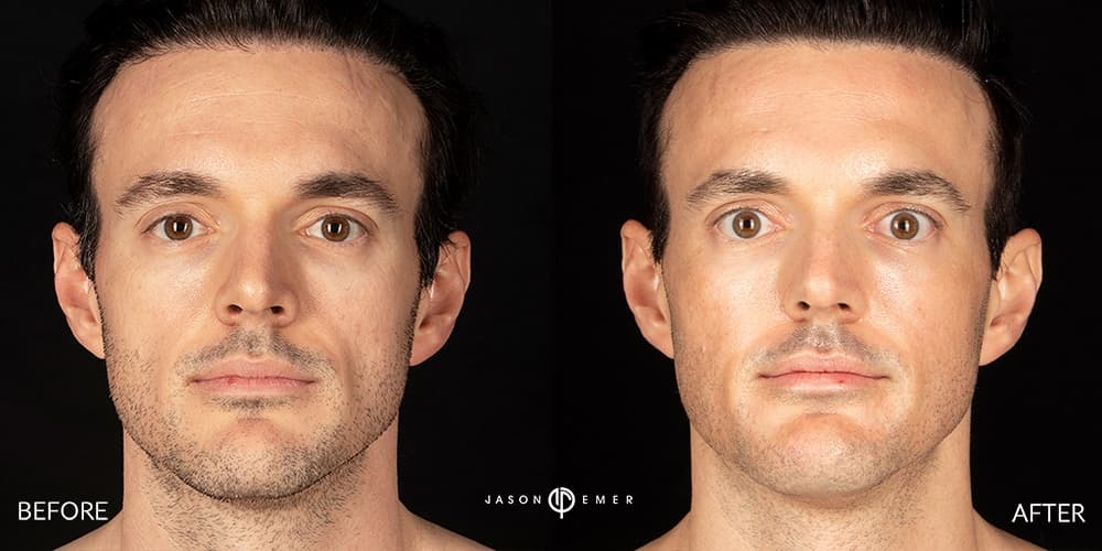 Patient before and after