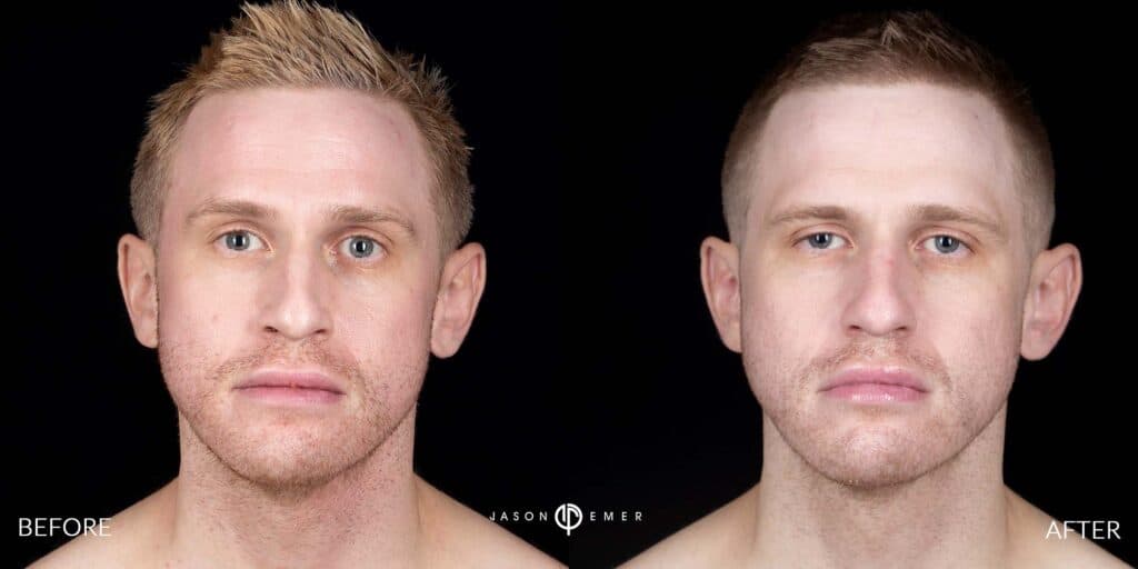 Patient before and after