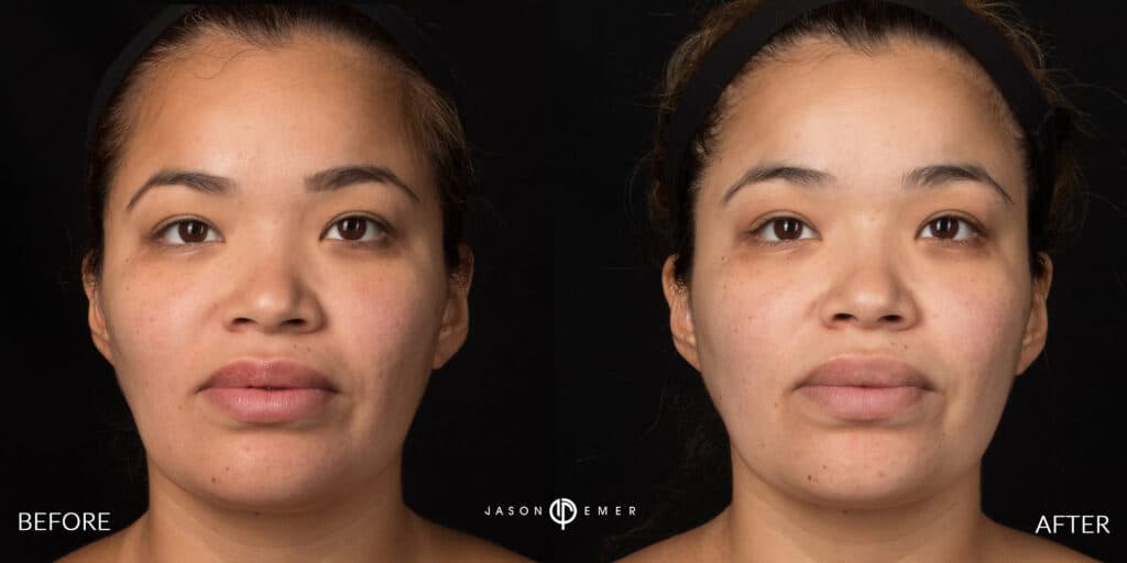 Patient before and after