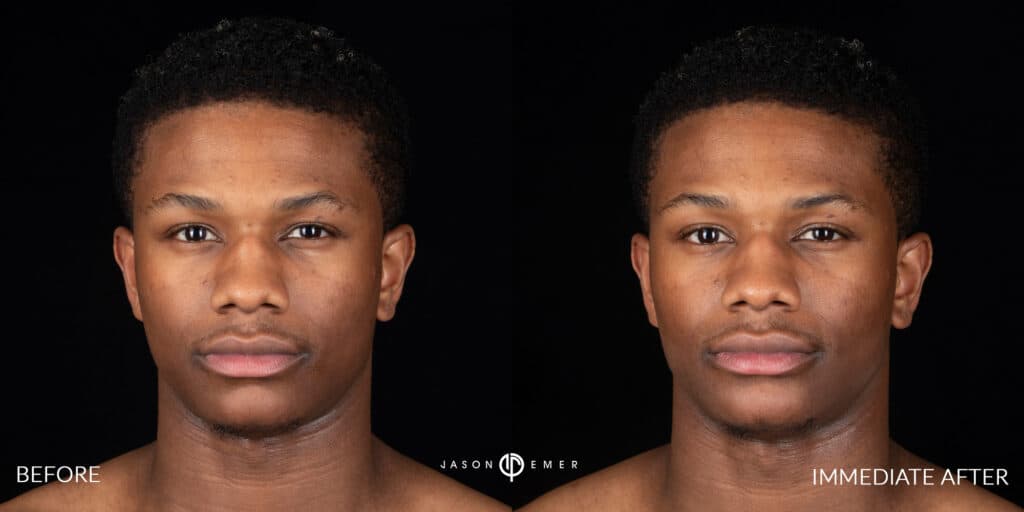 Patient before and after