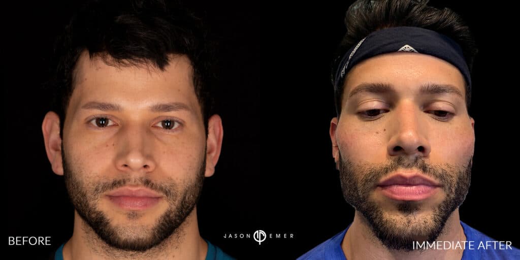 Patient before and after