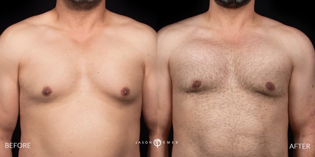 Patient before and after