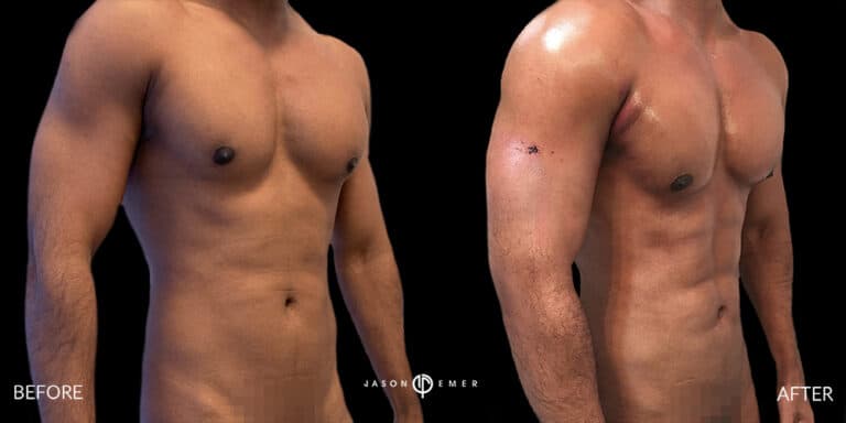 Abs Male Gallery 06