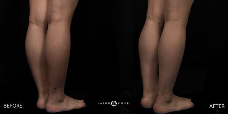 CALVES FEMALE GALLERY 01