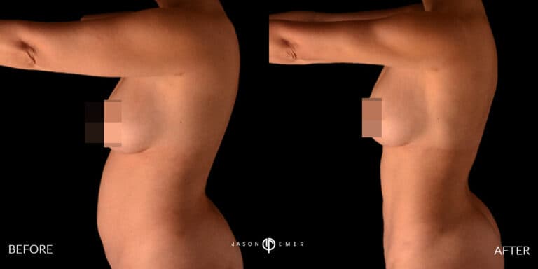 ABS FEMALE GALLERY 04