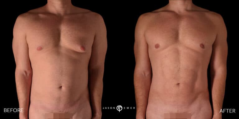 Full Body Male Gallery 04