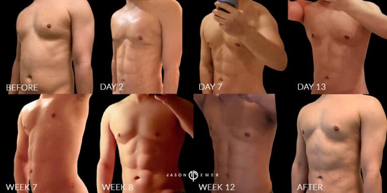 Abs Male Gallery 05