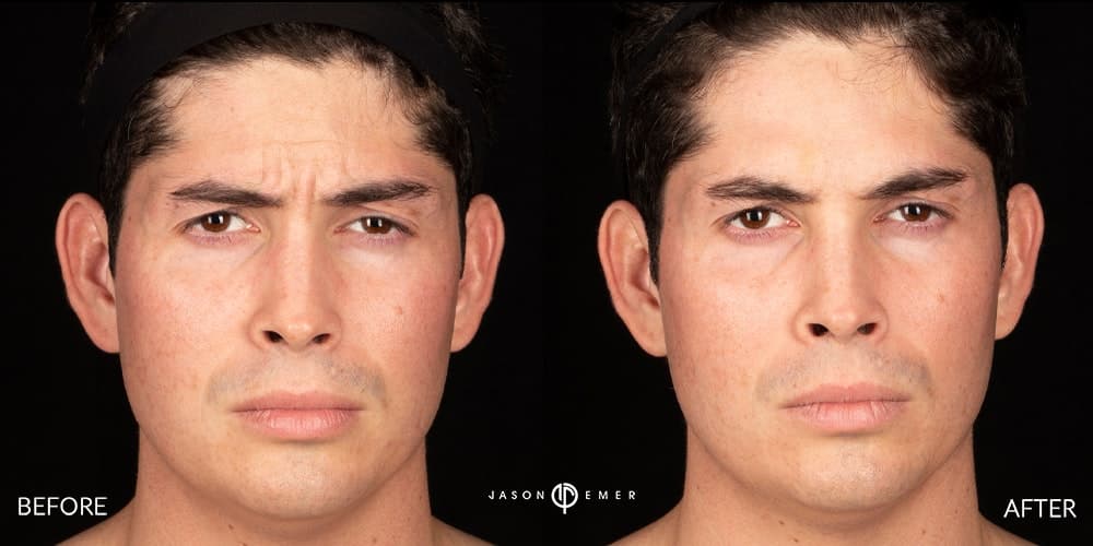 Patient before and after