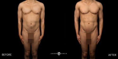 Full Body Male Gallery