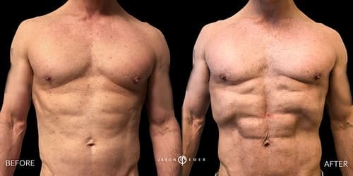 Abs Male Gallery