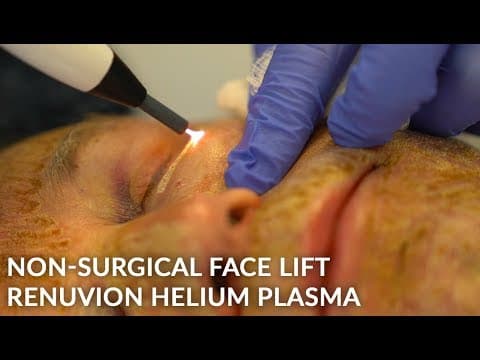Patient story video 2