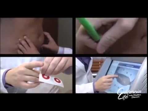 Patient story video 2