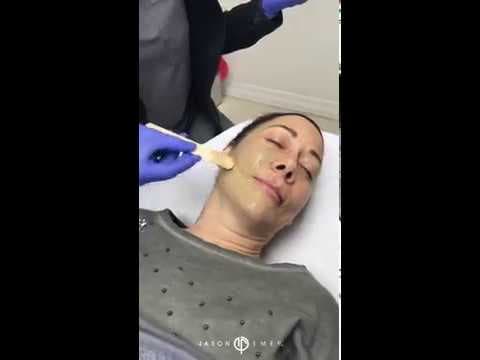 Patient story video 3