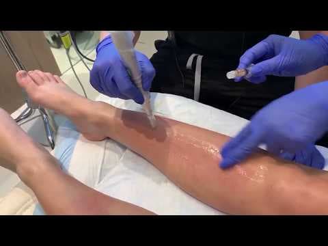 Patient story video 4