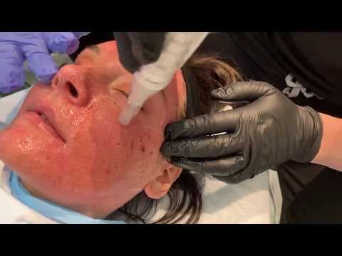 Patient story video 3