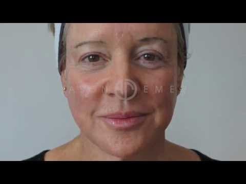 Patient story video 4