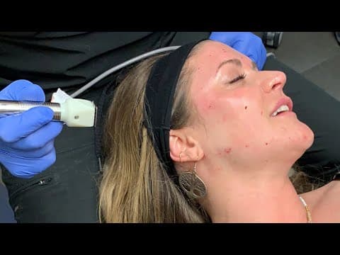 Patient story video 5