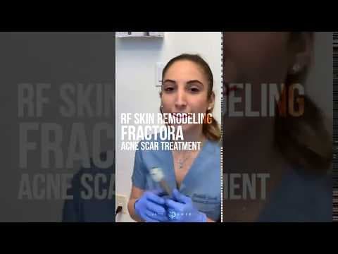 Patient story video 7