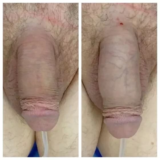 Patient 240285