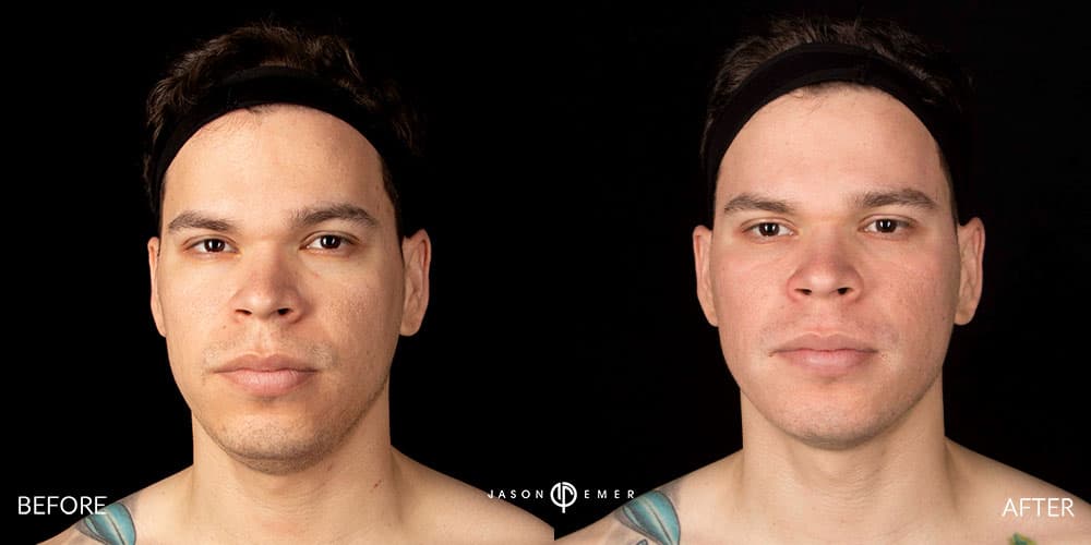 Patient before and after
