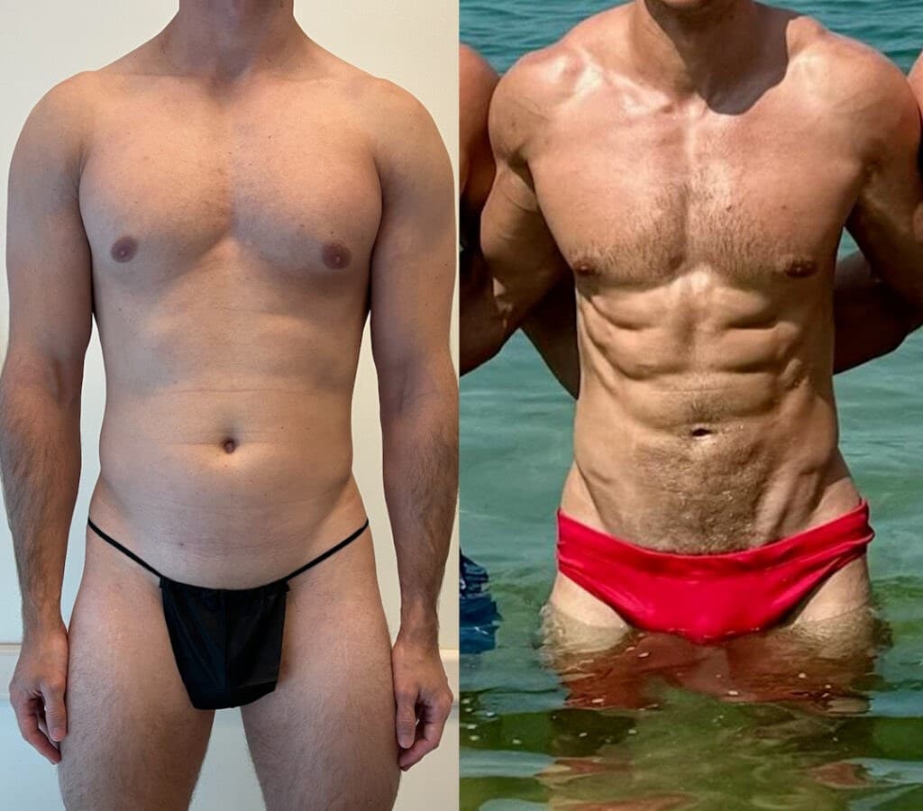 Male 360 HD Liposculpture before and after by Dr. Jason Emer in Beverly Hills