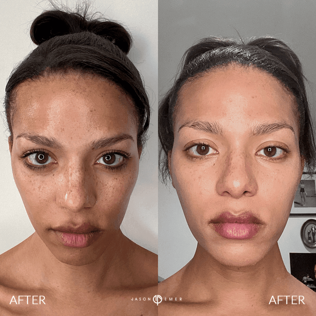 Patient before and after