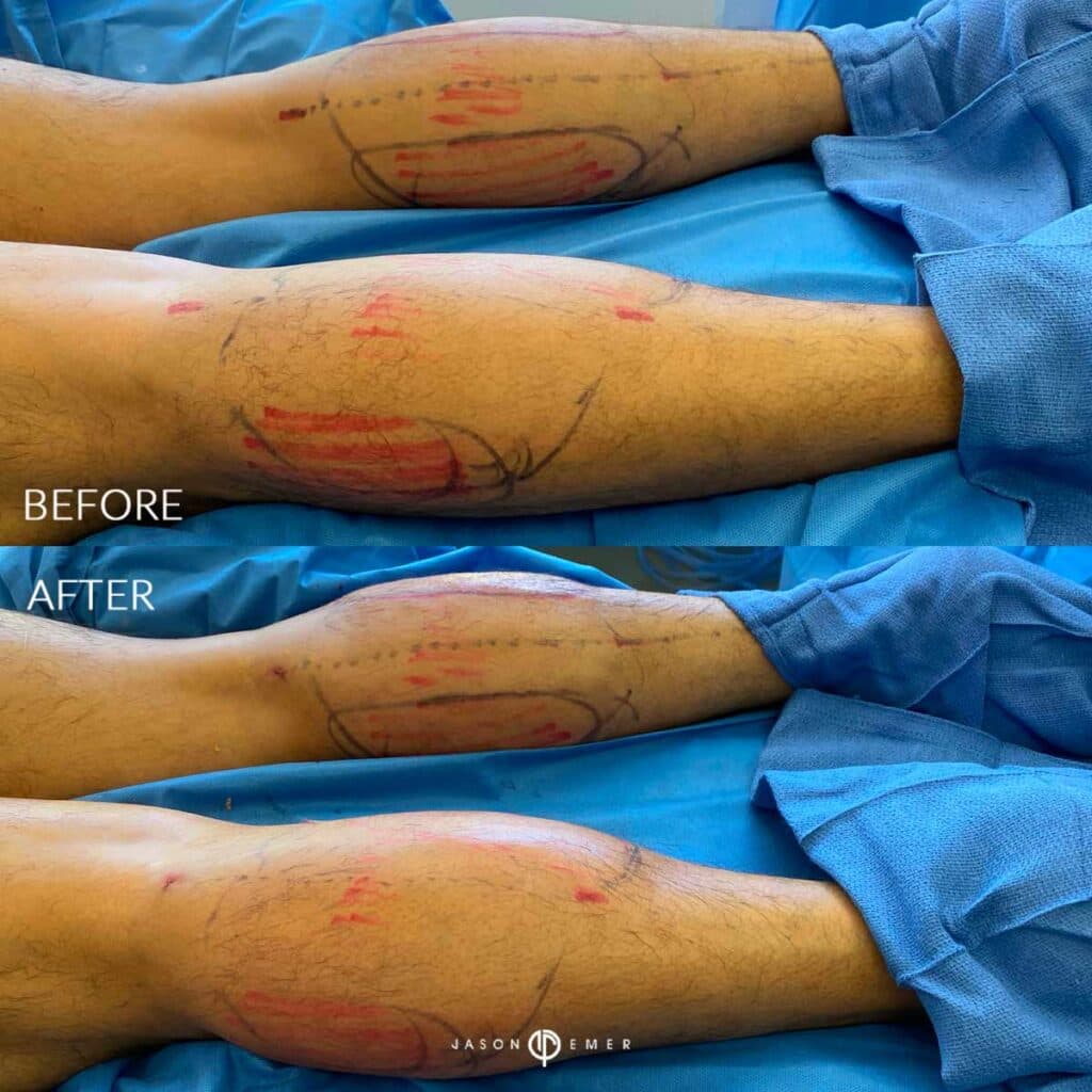 Patient before and after