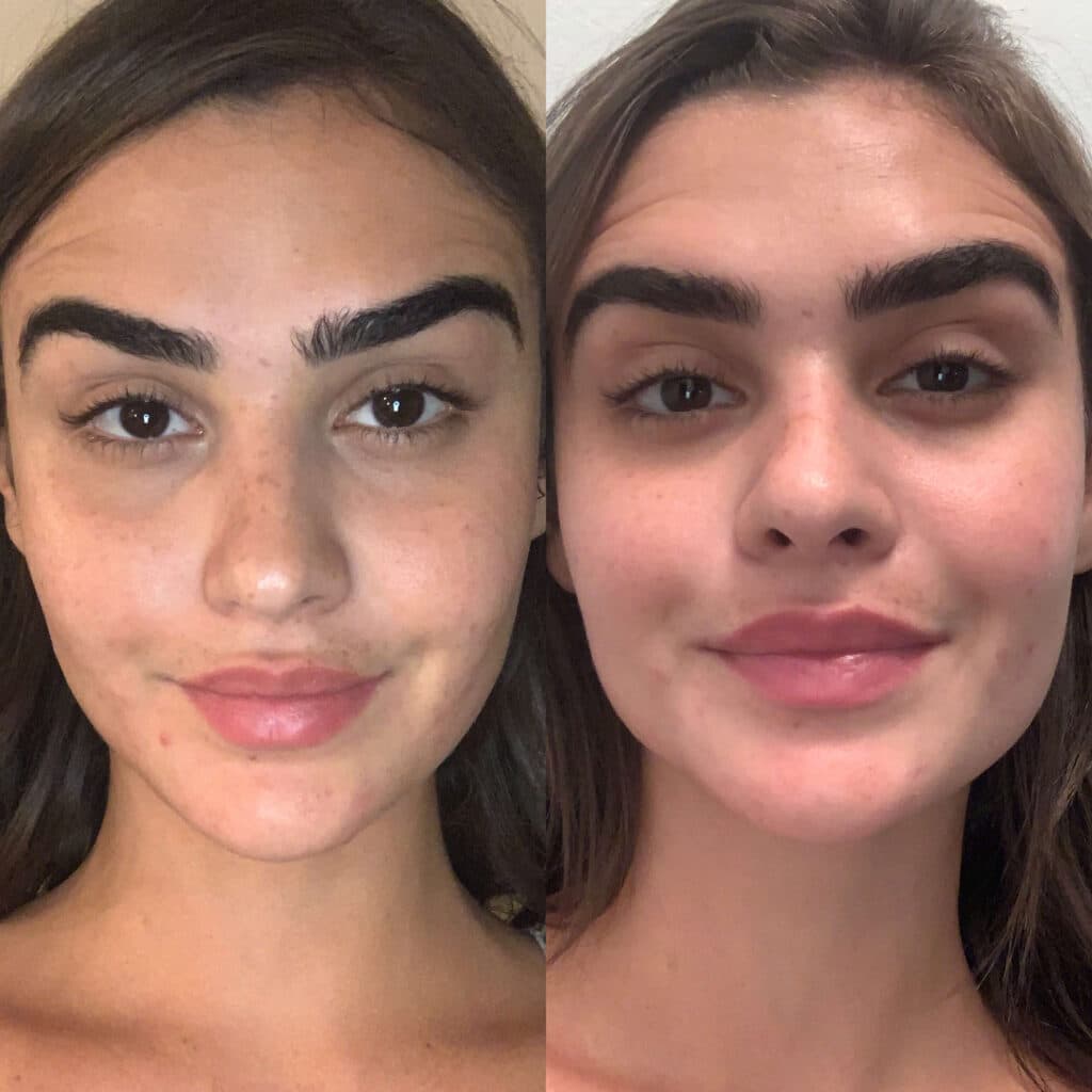Patient before and after