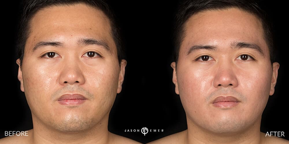 Patient before and after