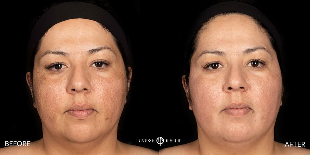 Patient before and after