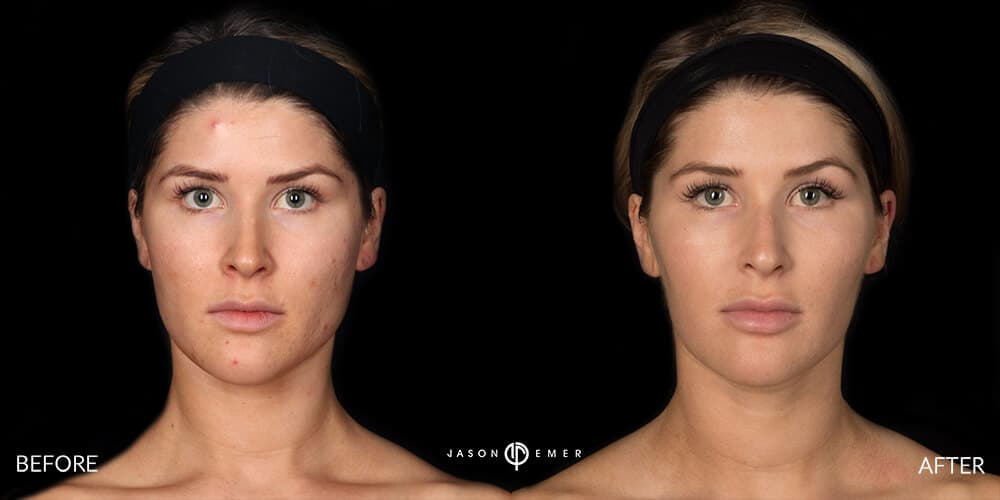 Patient before and after
