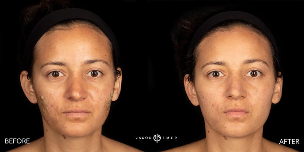 Patient before and after