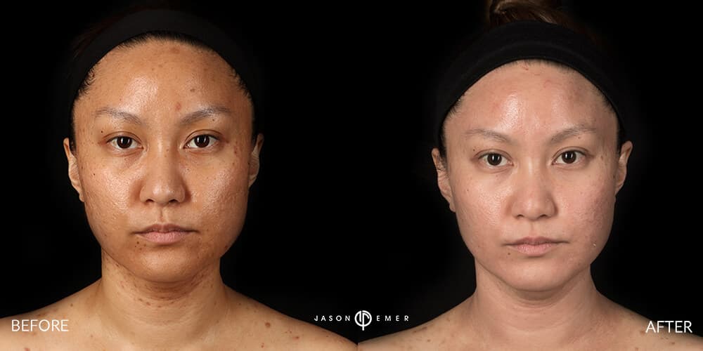 Patient before and after