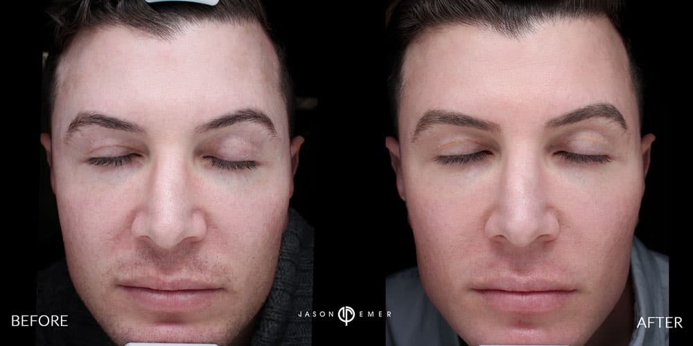 Patient before and after